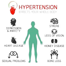 Hypertension